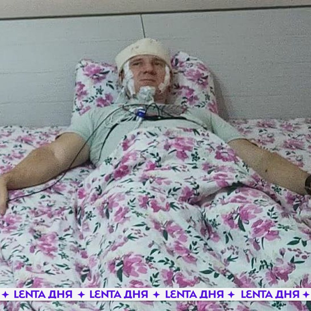 «Сам себе нейрохирург»: россиянин просверлил череп дрелью